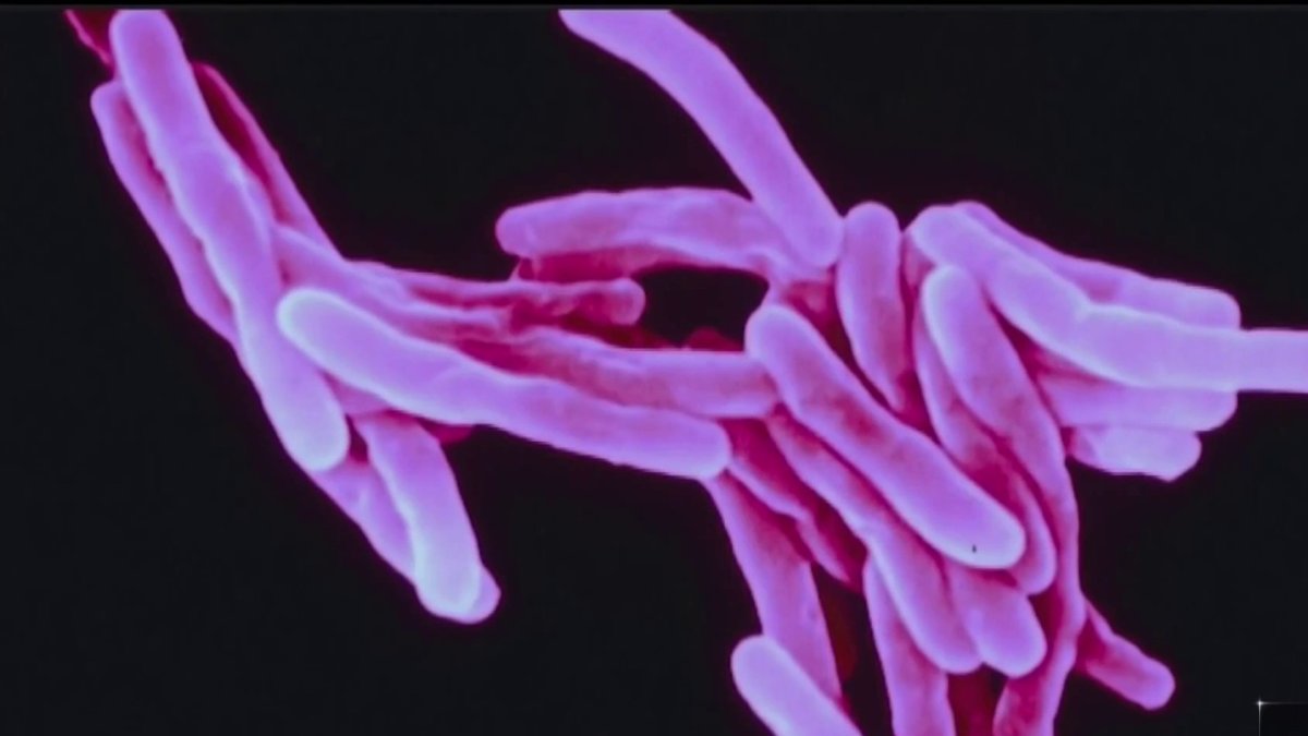 San Diego County TB Tracking Leads to Continuing Education College – NBC 7 San Diego