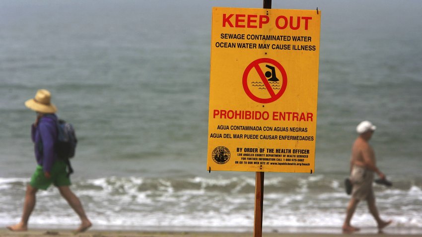 LOS ANGELES – AUGUST 09:  Warning signs keep bathers out of the water at the south end of Venice Beach on August 9, 2006 in Los Angeles, California. The closure of a two-mile stretch of beach near Ballona Creek, after a pumping station failure sent between 20,000 and 30,000 gallons of raw sewage into the ocean, is a common problem on many Los Angeles and Orange County beaches. According to a recently released study by the University of California-Los Angeles (UCLA) and Stanford University researches, pollution on Southern California beaches affects 1.5 million people each year. Reportedly, between 627,800 and 1,479,200 “excess” cases of gastrointestinal illness, generally associated with swimming in contaminated water, inflicts symptoms like stomach cramps, diarrhea and nausea. Healthcare costs for illnesses related to beach bacteria run from approximate $21 million to $414 millions a year.    (Photo by David McNew/Getty Images)