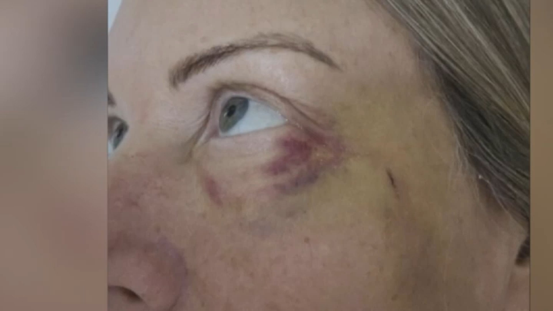 LA Animal Services employee mauled by dog – NBC 7 San Diego - Vimarsana News