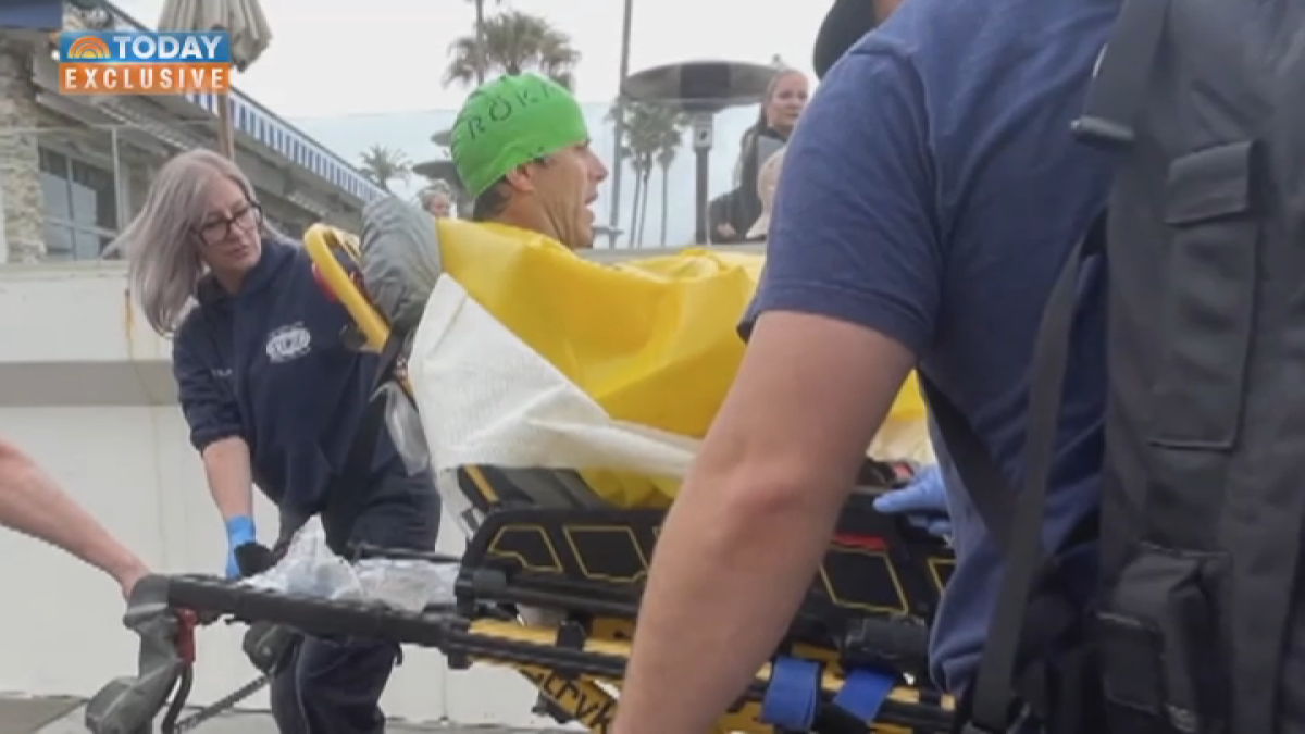 Del Mar shark attack survivor speaks out after incident – NBC 7 San Diego