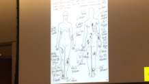 This diagram is one of two created by the San Diego Medical Examiner that shows the number of injuries they cataloged on Connie Dadkhah's body.