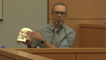 Jeremy Deisch, M.D. used an anatomical model of a skull to show the court what parts of Connie Dadkhah's skull was fractured.