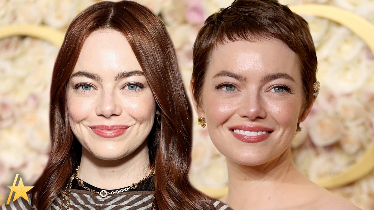 Emma Stone'S Hair Secret Is Finally Out: She'S Bald! - okyikvk