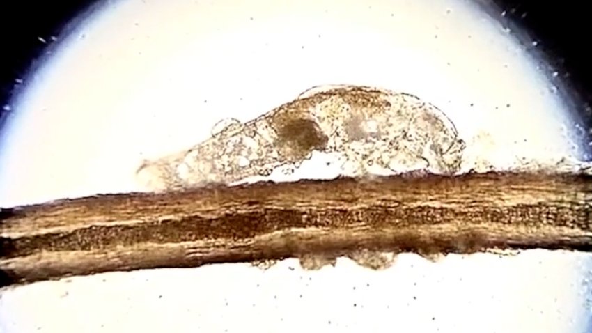 A close up of an eyelash mite.