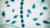 California could face another record-breaking year of Valley fever fungal infection