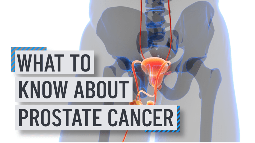 Text reading "what to know about prostate cancer" over an illustration of a man's pelvis and prostate