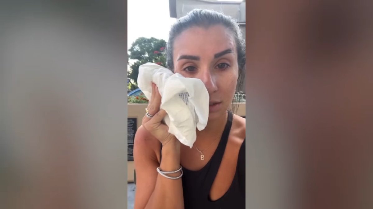 Woman ‘caught off guard' when stranger punched her in the face in Little Italy