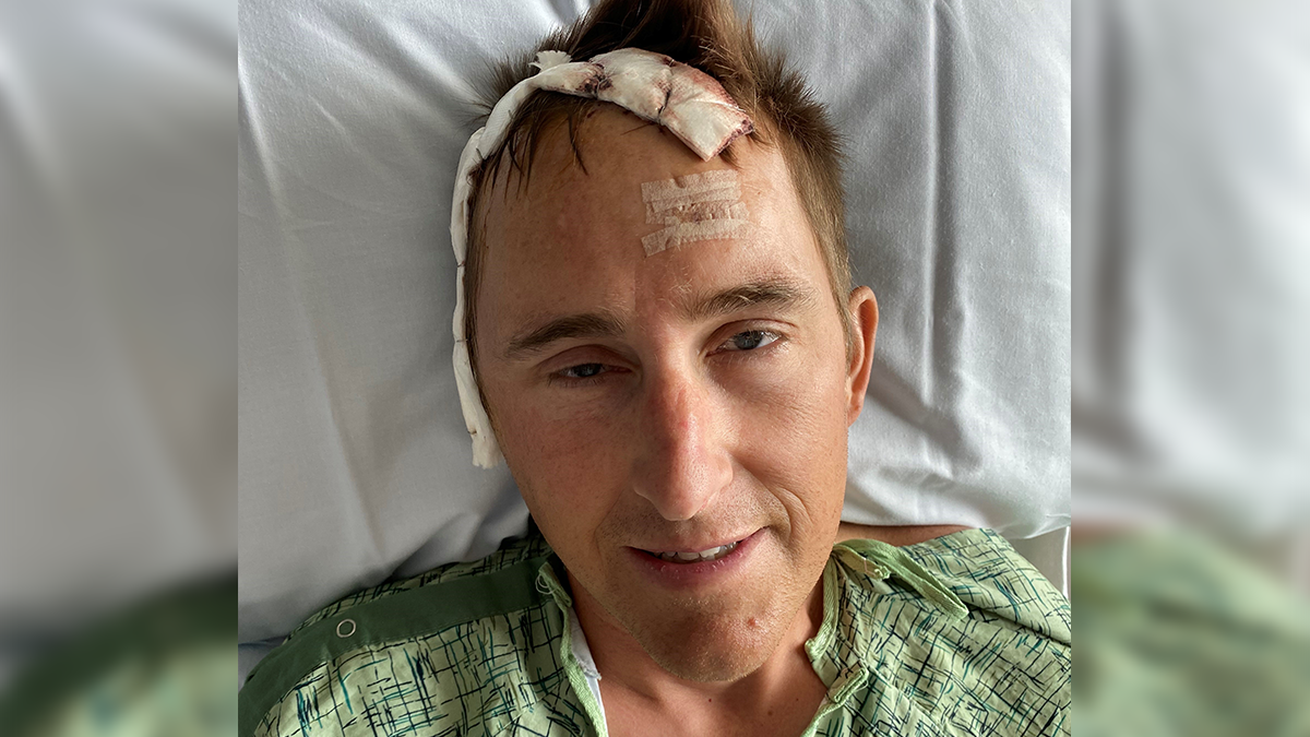 This photo from 2023 shows Andrew Dower after doctors successfully performed brain surgery on a tumor.
