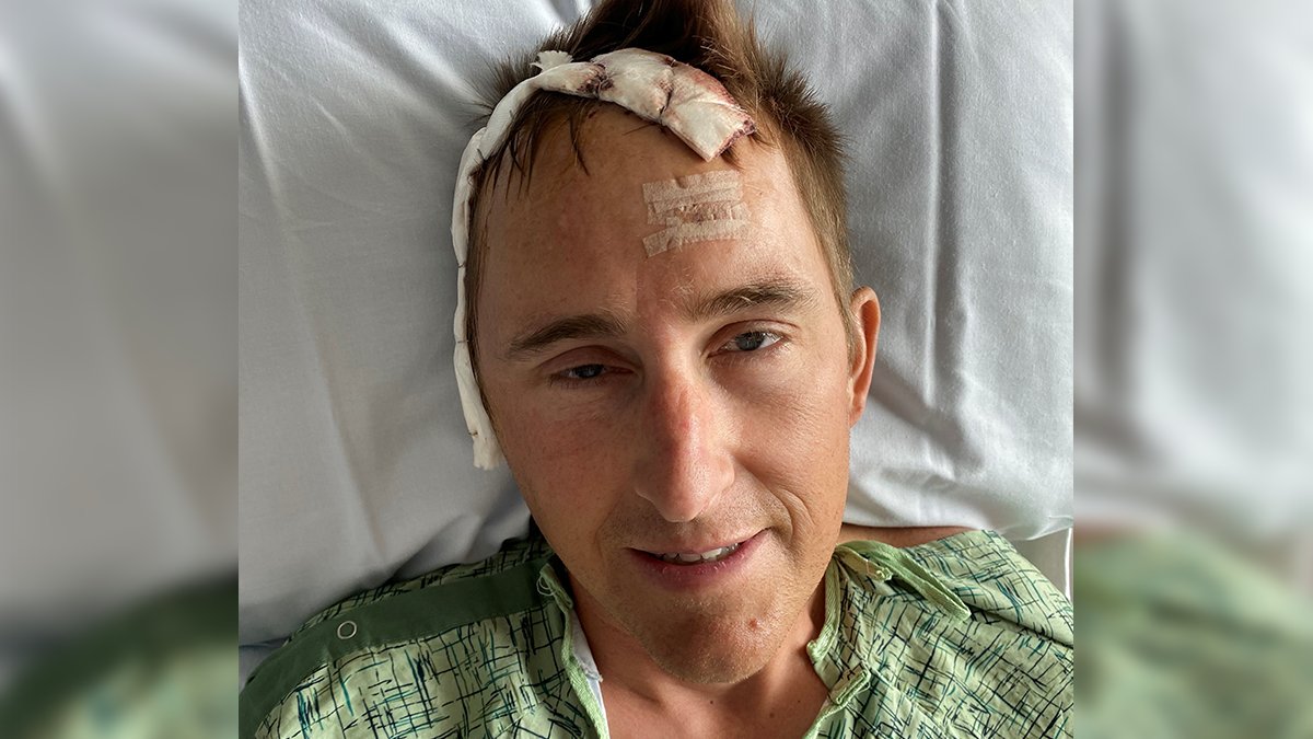 This photo from 2023 shows Andrew Dower after doctors successfully performed brain surgery on a tumor.