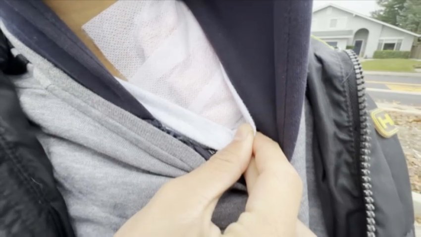 A 17-year-old boy shows the bandage covering his gunshot wound.