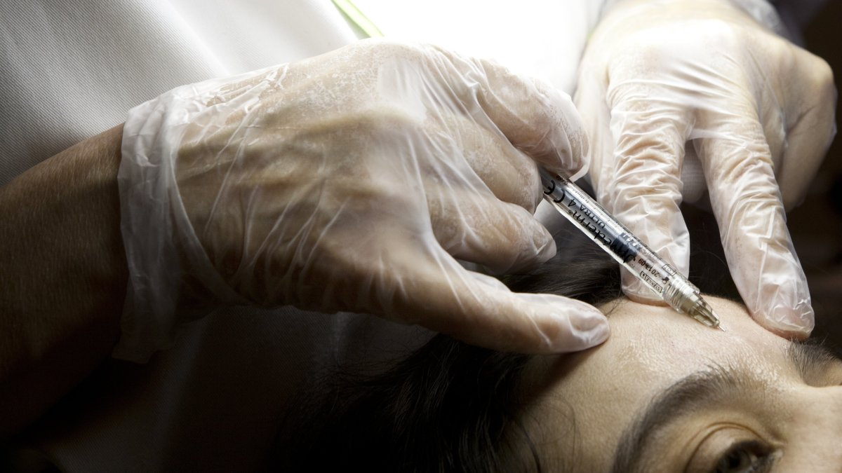 Glendale doctor charged with filing $45M fraudulent Botox claims – NBC ...