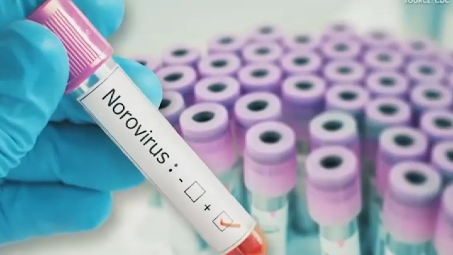 Norovirus cases on the rise in San Diego, health experts say