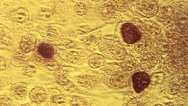 Herpes dating site san diego